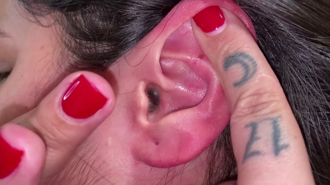 live inside my ear
